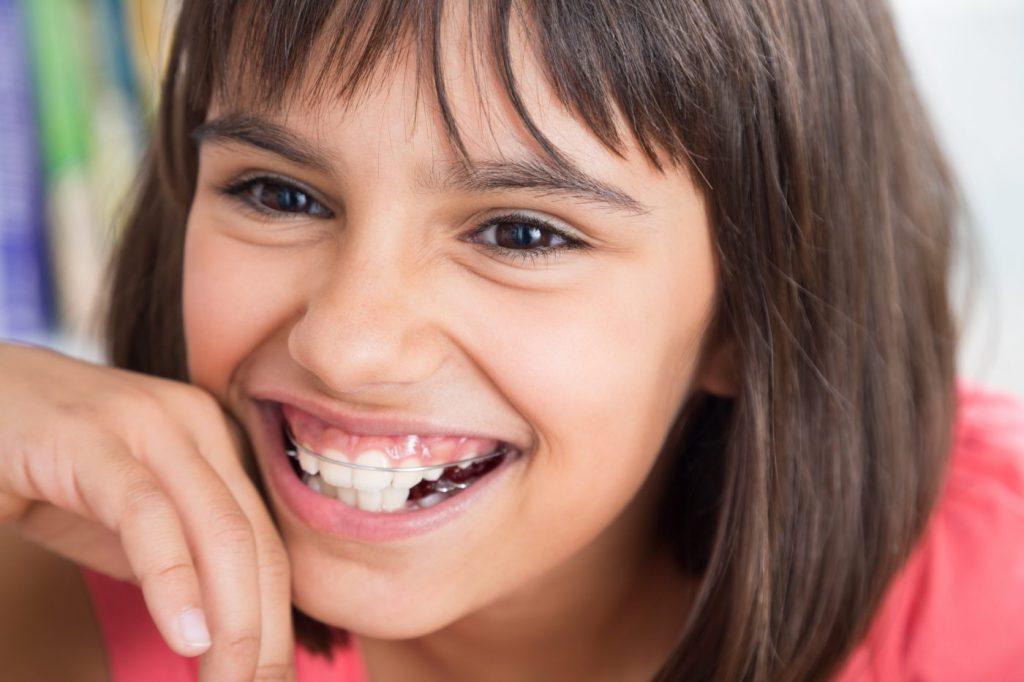 Orthodontic braces have evolved City Parent